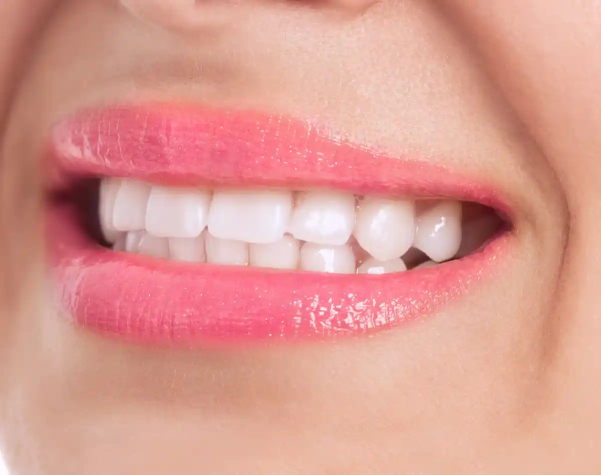 https://homeodent.co.in/wp-content/uploads/2022/10/Homeodent-Metal-Braces-Borivali-West-for-Adults-1.webp
