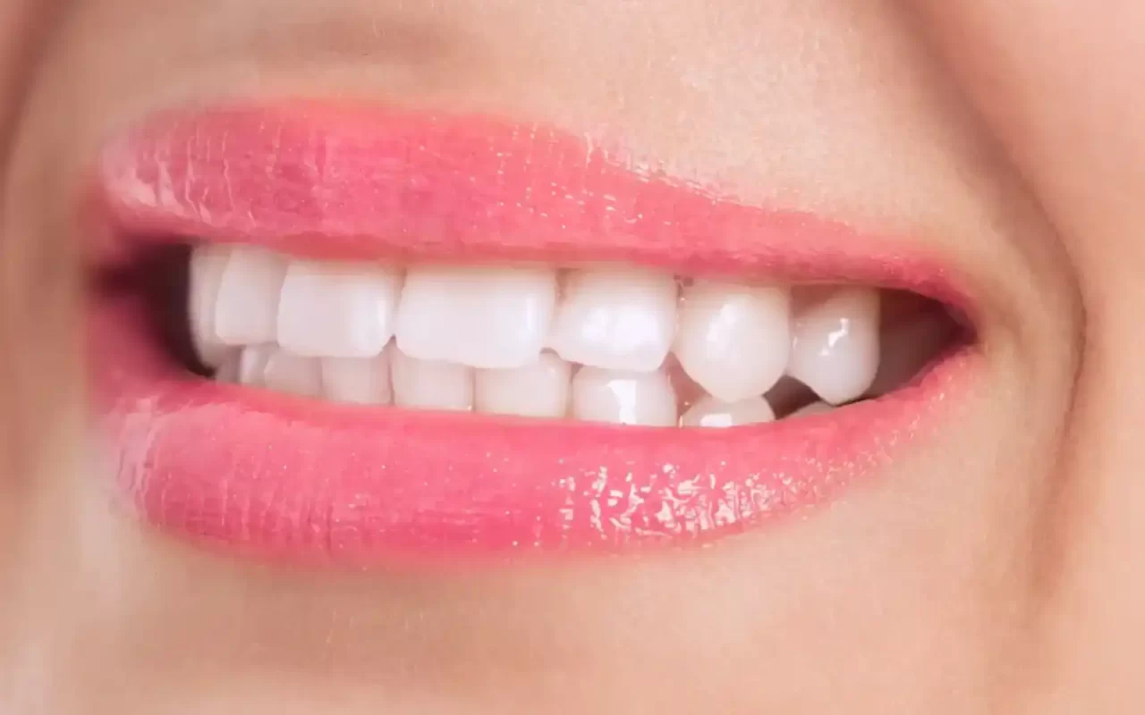 Homeodent Teeth Whitening Borivali West for Adults and teens