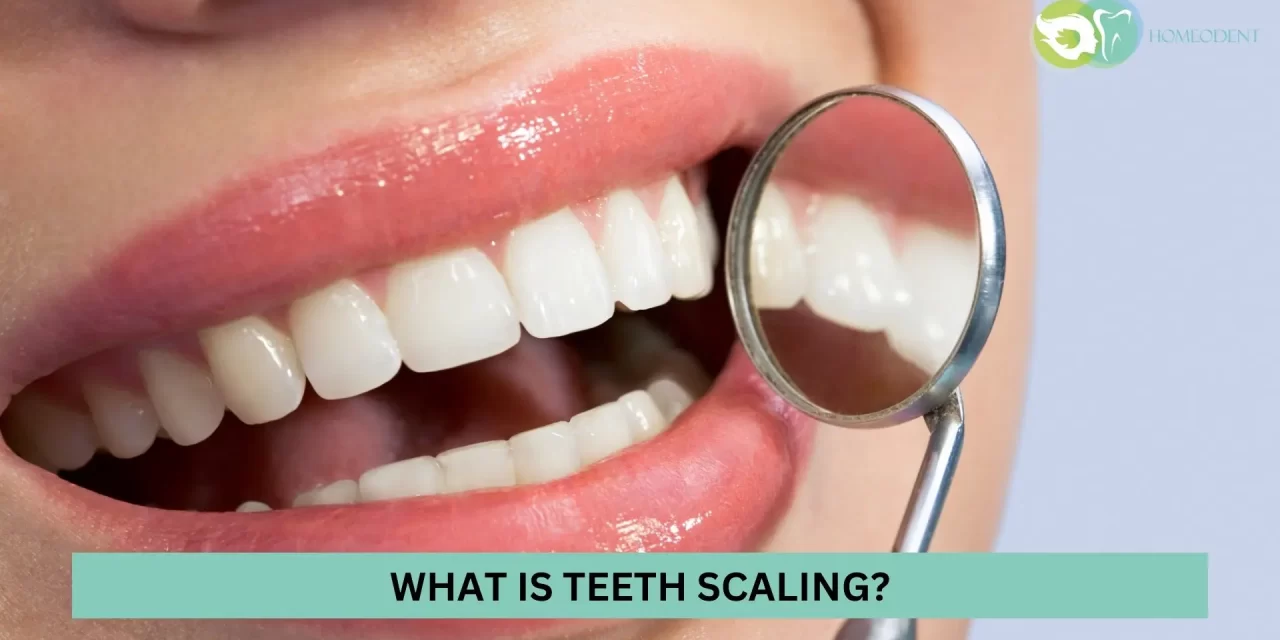 Teeth Scaling Helps Your Mouth Keep Healthy. It is Good?