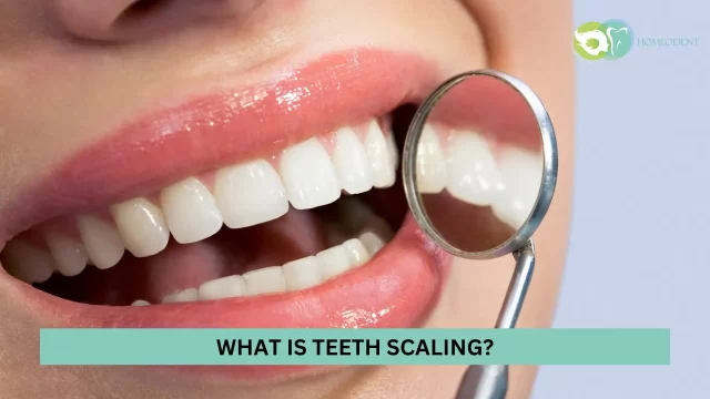 Teeth Scaling