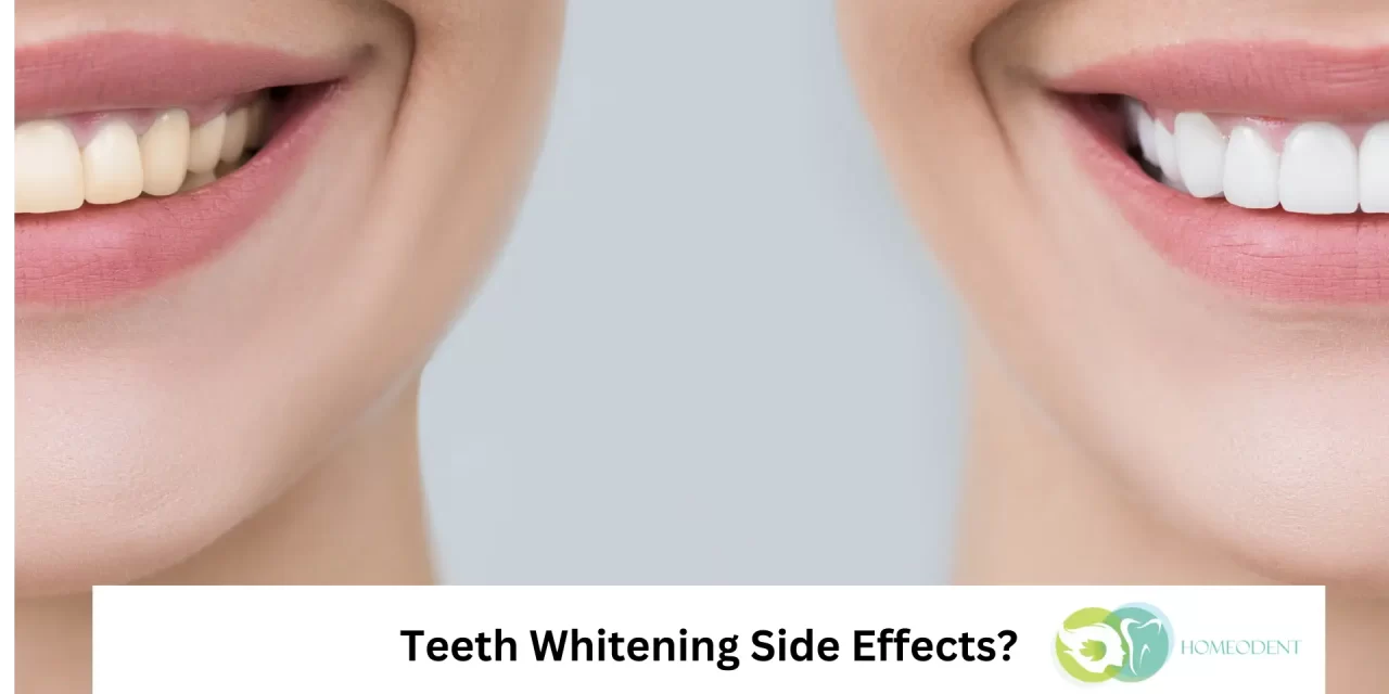 Exploring The Most Common Side Effects of Teeth Whitening?