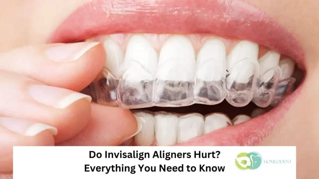 Method of using Invisalign to strengthen the teeth