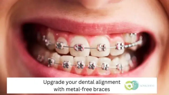Upgrade Your Dental Alignment with Metal-Free Braces