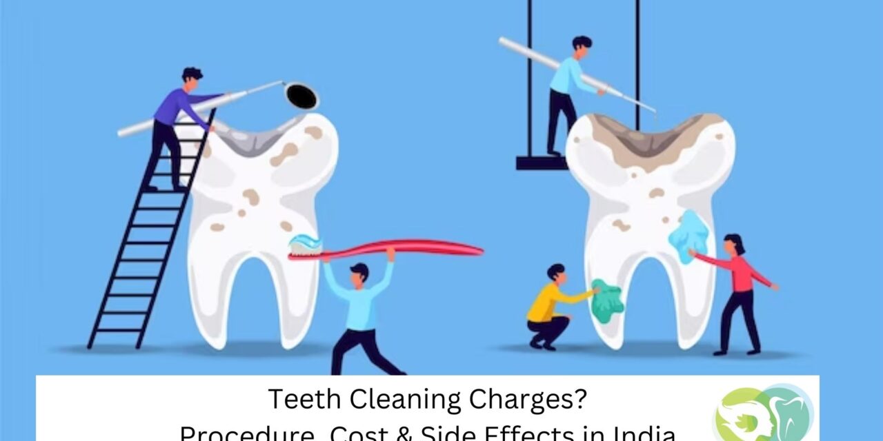 Teeth Cleaning Cost Without Insurance? 3 types of Procedure you should know?