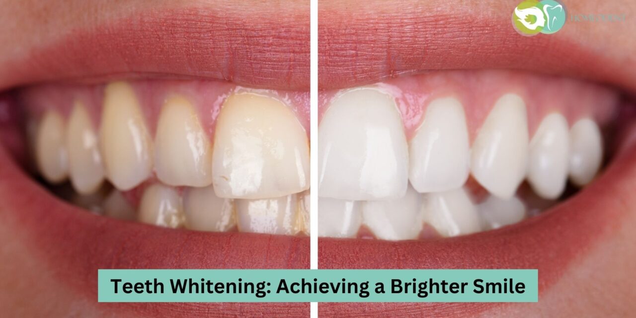 Teeth Whitening: Achieve great Brighter Smile