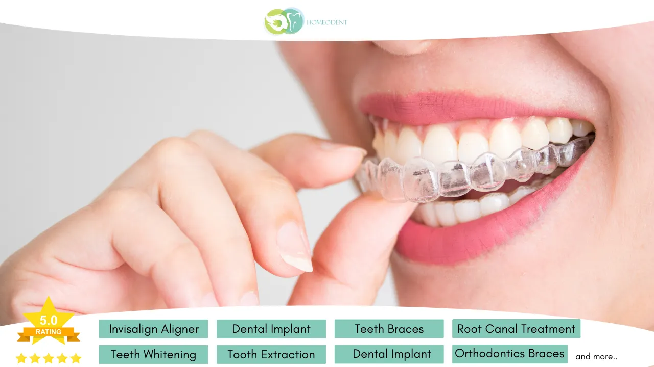 Teeth Braces Cost Making Quality Affordable - Homeodent Multispeciality Orthodontics Clinic - Dentist in Borivali West. Invisalign, Ceramic Metal Braces Treatment