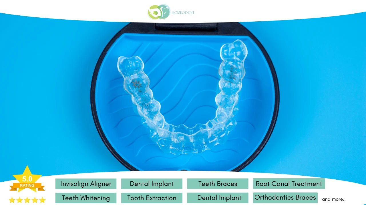 Various types of braces at Homeodent Clinic - Homeodent Multispeciality Orthodontics Clinic - Dentist in Borivali West Invisalign, Ceramic, Metal Braces Treatment