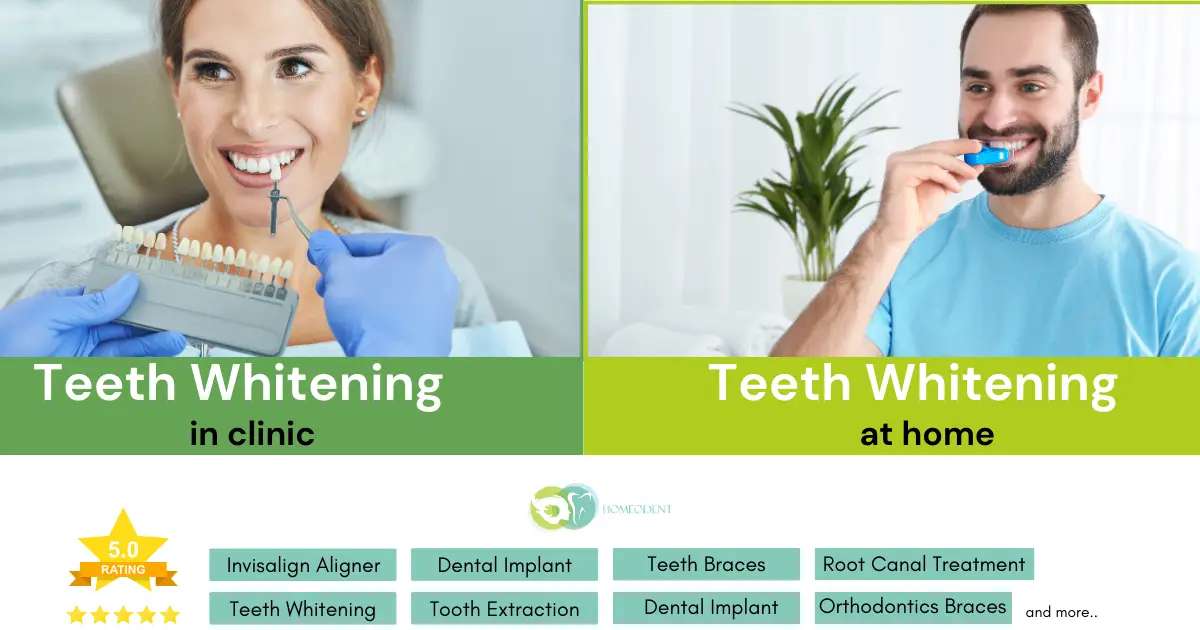 Teeth Whitening in Clinic or At Home | Which is Best for You?