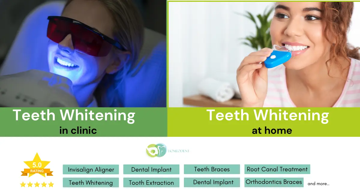 Types of Teeth Whitening Treatments by by Dentist in Borivali _ Homeodent Multispeciality Orthodontic Dental Clinic