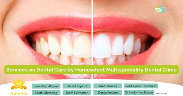 Services on Dental Care by Homeodent Multispeciality Dental Clinic